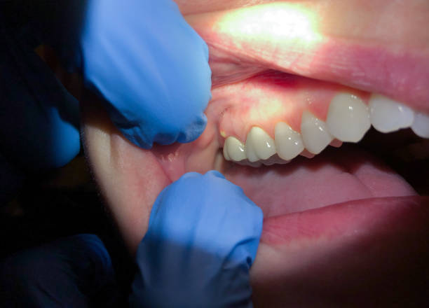 Best Pediatric Emergency Dentist in Slippery Rock University, PA